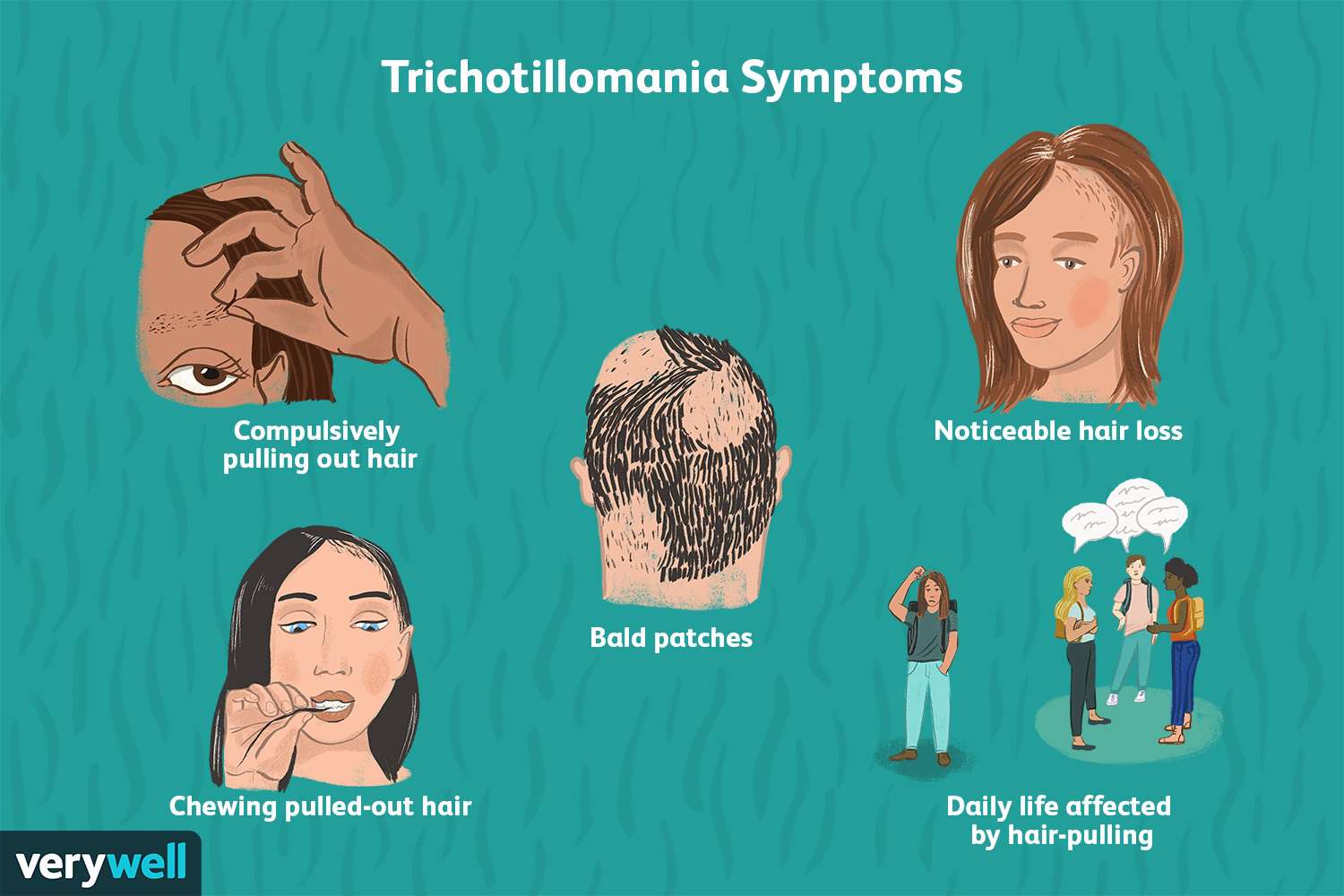 what is trichotillomania